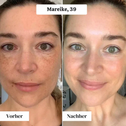 Dile adiós a las arrugas – Mascarilla con Colágeno 100% Natural