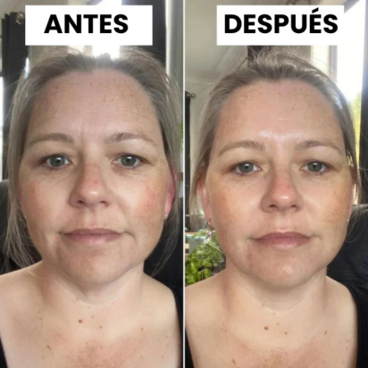 Dile adiós a las arrugas – Mascarilla con Colágeno 100% Natural